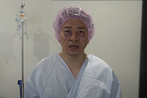 宮迫博之の美容整形前